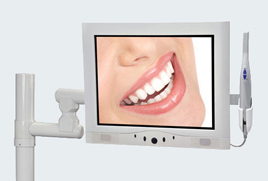 Telecamera intraorale