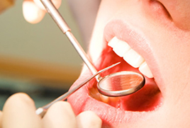 Trattamenti di endodonzia