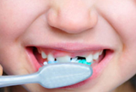 Dentista per bambini